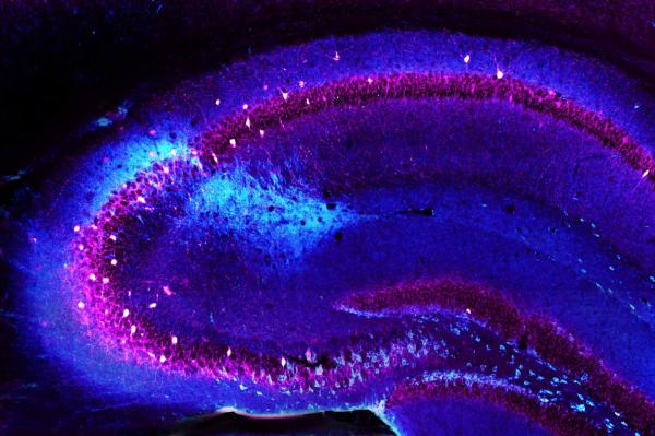 Loss of cells in brain's memory center linked to schizophrenia