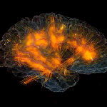 neurons firing in the brain